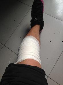 腿受伤住院照片